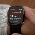 La función ECG del Apple Watch salva a una mujer embarazada y a su bebé